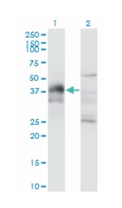 DLX3, Mouse, Clone: 3C3, Abnova 100&mu;g; Unlabeled:Antibodies, Monoclonal