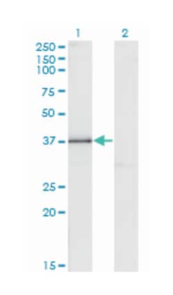 DLX3, Mouse, Clone: 3F7, Abnova 100&mu;g; Unlabeled:Antibodies, Monoclonal