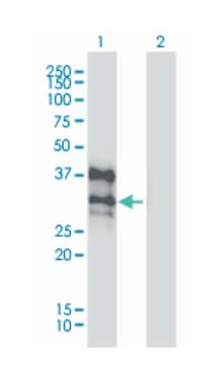 DLX4, Mouse, Clone: 1F11, Abnova 100&mu;g; Unlabeled:Antibodies, Monoclonal