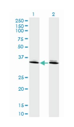 DLX6, Mouse, Clone: 2D7, Abnova 100 &mu;g | Buy Online | Abnova Corporation | Fisher Scientific