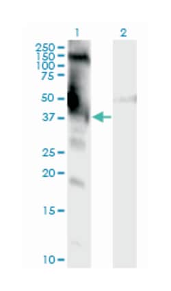 DMWD, Mouse, Clone: 3F5, Abnova 100 &mu;g | Buy Online | Abnova Corporation | Fisher Scientific