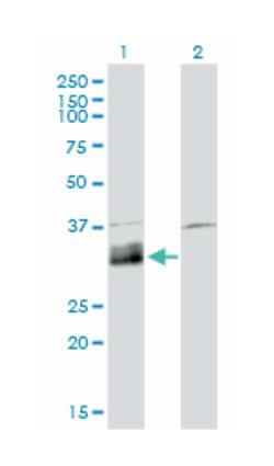 DNASE1L1, Mouse, Clone: 4E8, Abnova 100&mu;g; Unlabeled:Antibodies, Monoclonal