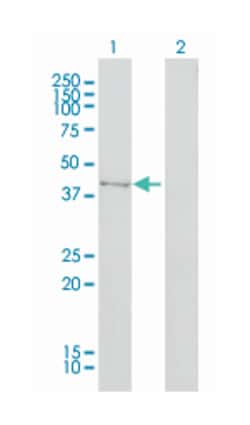 tRNA aspartic acid methyltransferase 1, Mouse, Clone: 1E12, Abnova 100&mu;g;