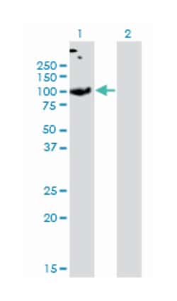 SLC26A2, Mouse, Clone: 3F6, Abnova 100&mu;g; Unlabeled:Antibodies, Monoclonal