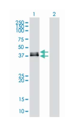 dual specificity phosphatase 6, Mouse, Clone: 3G2, Abnova 100 &mu;g | Buy Online | Abnova | Fisher Scientific