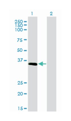 ELAVL4, Mouse, Clone: 6B9, Abnova 100&mu;g; Unlabeled:Antibodies, Monoclonal