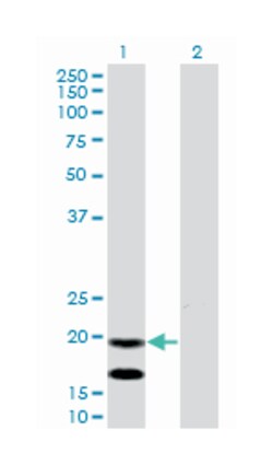 EMP3, Mouse, Clone: 3D4, Abnova 100&mu;g; Unlabeled:Antikörper
