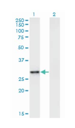 EPHA7, Mouse, Clone: 3C3, Abnova 200 &mu;L | Buy Online | Abnova Corporation | Fisher Scientific