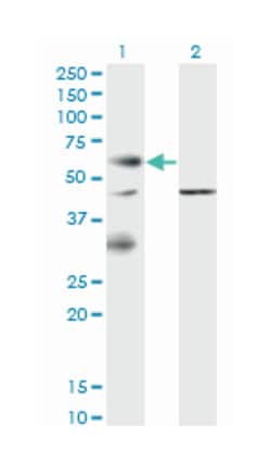 EPOR, Mouse, Clone: 3F6, Abnova 100&mu;g; Unlabeled:Antibodies, Monoclonal