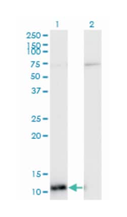 enhancer of rudimentary homolog (Drosophila), Mouse, Clone: 4A10, Abnova 100 &mu;g | Buy Online | Abnova Corporation | Fisher Scientific