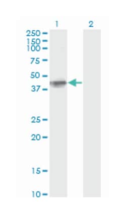 FCER2, Mouse, Clone: S51, Abnova 200&mu;L; Unlabeled:Antibodies, Monoclonal