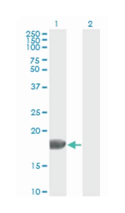 fibroblast growth factor 1 (acidic), Mouse, Clone: 2E12, Abnova 100&mu;g;