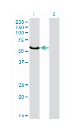 FGR, Mouse, Clone: 1B12, Abnova 100&mu;g; Unlabeled:Antibodies, Monoclonal