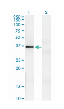 FRZB, Mouse, Clone: 3C3, Abnova&trade;
