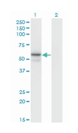 FUCA1, Mouse, Clone: 1D4, Abnova 100 &mu;g | Buy Online | Abnova Corporation | Fisher Scientific