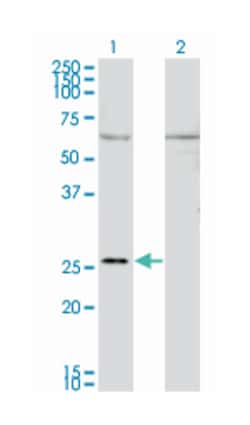 GAP43, Mouse, Clone: 3C11, Abnova 100 &mu;g | Buy Online | Abnova Corporation | Fisher Scientific