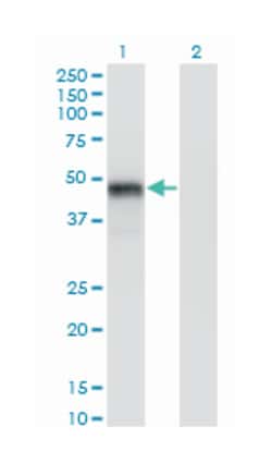 GATA binding protein 3, Mouse, Clone: 1C1, Abnova 100&mu;g; Unlabeled:Antibodies,