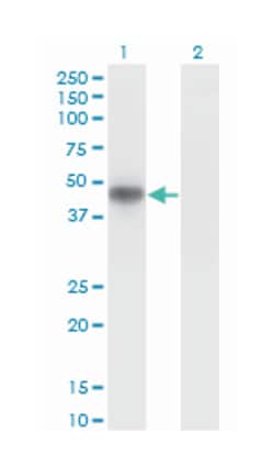 MAP kinase interacting serine/threonine kinase 2, Mouse, Clone: 4F11, Abnova