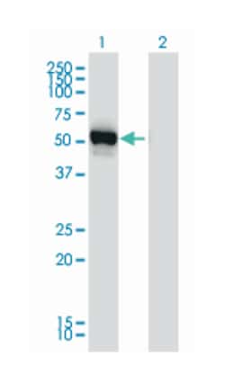 glutamic-pyruvate transaminase (alanine aminotransferase), Mouse, Clone: