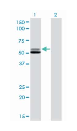 GSR, Mouse, Clone: 6B4, Abnova 100&mu;g; Unlabeled:Antibodies, Monoclonal