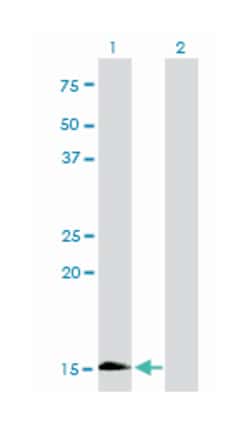 HBZ, Mouse, Clone: 3C4-1D5, Abnova 100&mu;g; Unlabeled:Antibodies, Monoclonal