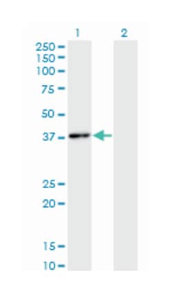 hematopoietically expressed homeobox, Mouse, Clone: 1A5, Abnova 100&mu;g;