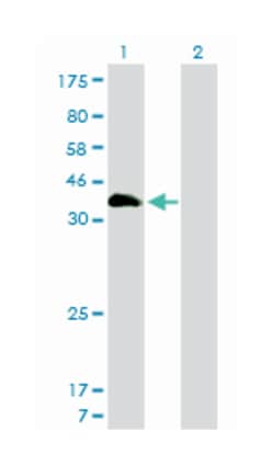 homeobox A11, Mouse, Clone: 7E12, Abnova 100&mu;g; Unlabeled:Anticuerpos