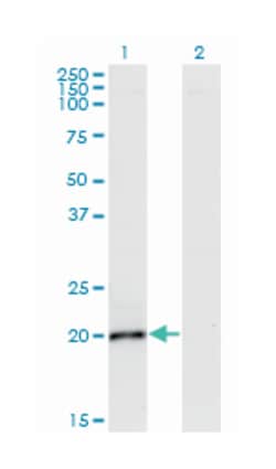 IL6, Mouse, Clone: 2D12, Abnova 100&mu;g; Unlabeled:Antibodies, Monoclonal