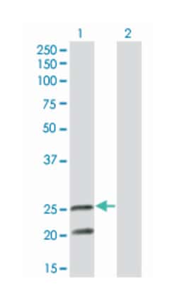 IL6, Mouse, Clone: 3E8, Abnova 100 &mu;g | Buy Online | Abnova Corporation | Fisher Scientific