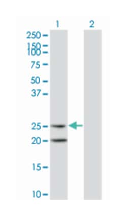 IL6, Mouse, Clone: 4H5, Abnova 100 &mu;g | Buy Online | Abnova Corporation | Fisher Scientific