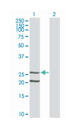 IL6, Mouse, Clone: 1G8, Abnova 100 &mu;g | Buy Online | Abnova Corporation | Fisher Scientific