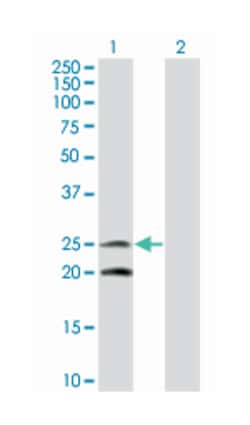 IL6, Mouse, Clone: 2C5, Abnova 100 &mu;g | Buy Online | Abnova Corporation | Fisher Scientific
