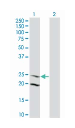 IL6, Mouse, Clone: 3F12, Abnova 100 &mu;g | Buy Online | Abnova Corporation | Fisher Scientific