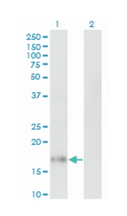 interleukin 10, Mouse, Clone: 1C10, Abnova 50 &mu;g | Buy Online | Abnova Corporation | Fisher Scientific