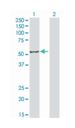 interferon regulatory factor 4, Mouse, Clone: 3A10, Abnova&trade;