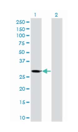 ketohexokinase (fructokinase), Mouse, Clone: 1H6-2B6, Abnova 100&mu;g;