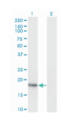 KiSS-1 metastasis-suppressor, Mouse, Clone: 1F7, Abnova&trade;