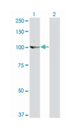 v-kit Hardy-Zuckerman 4 feline sarcoma viral oncogene homolog, Mouse, Clone: