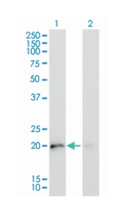 KRAS, Mouse, Clone: 4F3, Abnova 200&mu;L; Unlabeled:Antibodies, Monoclonal
