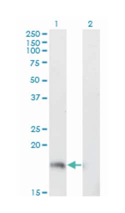 stathmin 1/oncoprotein 18, Mouse, Clone: 3A9, Abnova 200&mu;L; Unlabeled:Antibodies,