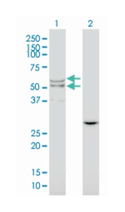 lipase A, lysosomal acid, cholesterol esterase, Mouse, Clone: 1F9, Abnova 100 &mu;g | Buy Online | Abnova Corporation | Fisher Scientific