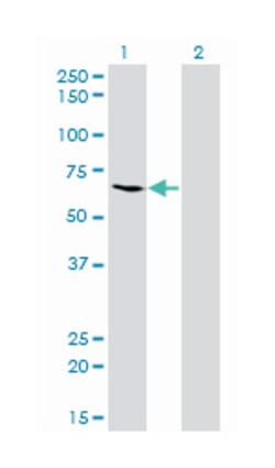 malic enzyme 1, NADP(+)-dependent, cytosolic, Mouse, Clone: 3H5, Abnova