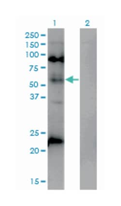 methyl CpG binding protein 2 (Rett syndrome), Mouse, Clone: 4B6, Abnova