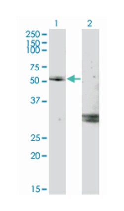 MYOC, Mouse, Clone: 2B4, Abnova 100 &mu;g | Buy Online | Abnova Corporation | Fisher Scientific