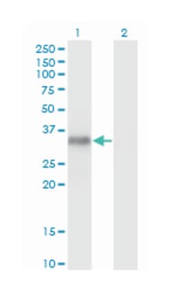myogenin (myogenic factor 4), Mouse, Clone: 2E7, Abnova™