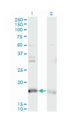 NDUFA8, Mouse, Clone: 2E10, Abnova 100 &mu;g | Buy Online | Abnova Corporation | Fisher Scientific