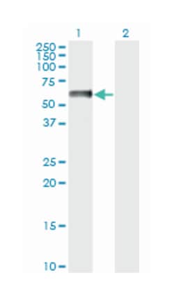 NFIA, Mouse, Clone: 1E11, Abnova 200&mu;L; Unlabeled:Antibodies, Monoclonal