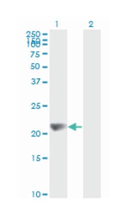 nonmetastatic cells 1, protein (NM23A) expressed in, Mouse, Clone: 1D7,
