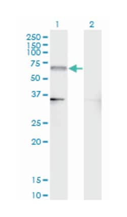 nuclear receptor subfamily 4, group A, member 2, Mouse, Clone: 4A6, Abnova