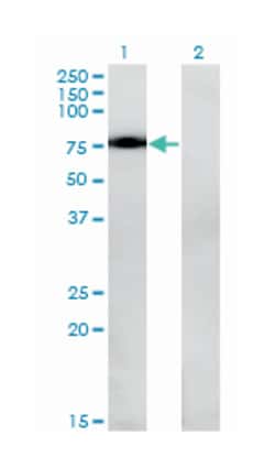 NR4A2, Mouse, Clone: 2G5, Abnova 100 &mu;g | Buy Online | Abnova Corporation | Fisher Scientific